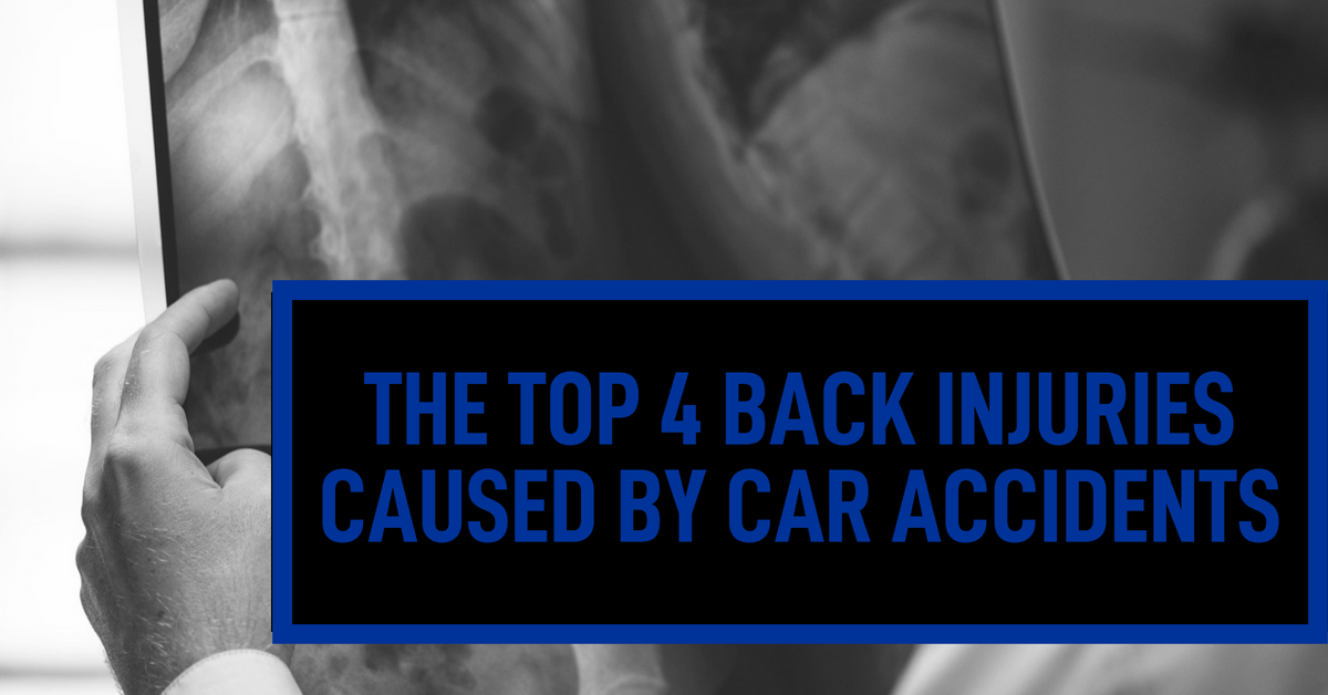 top-4-back-injuries-caused-by-car-accidents